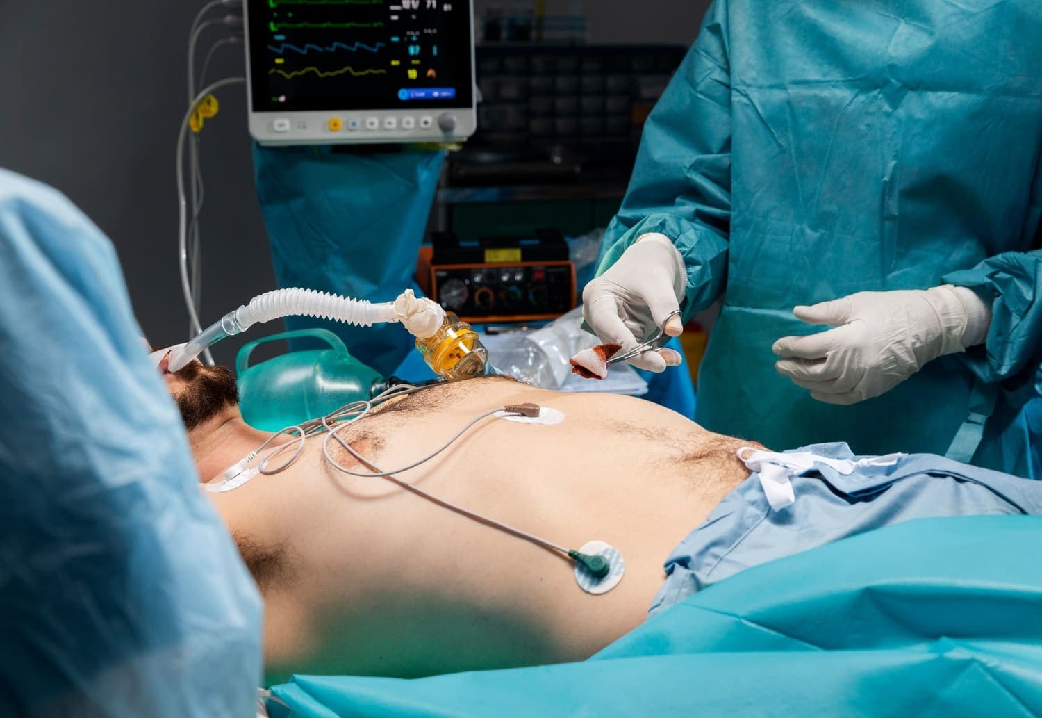 Laparoscopic Surgery